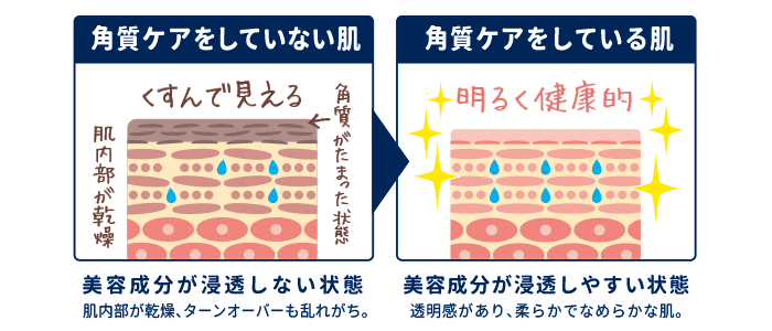 角質ケアをしていない肌と角質ケアをしている肌