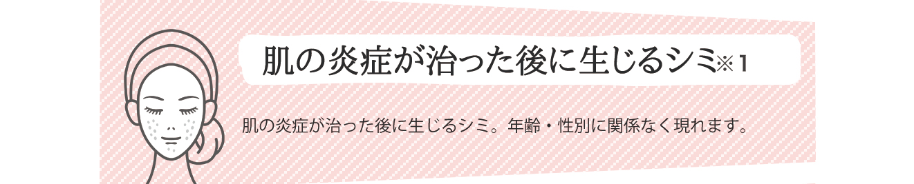 肌の炎症が治った後に生じるシミ